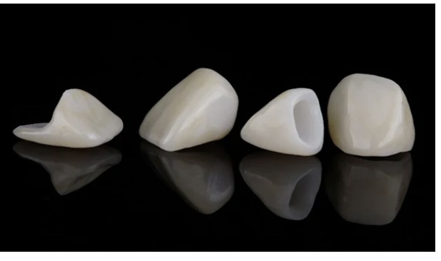 How to Care for a New Dental Crown or Filling