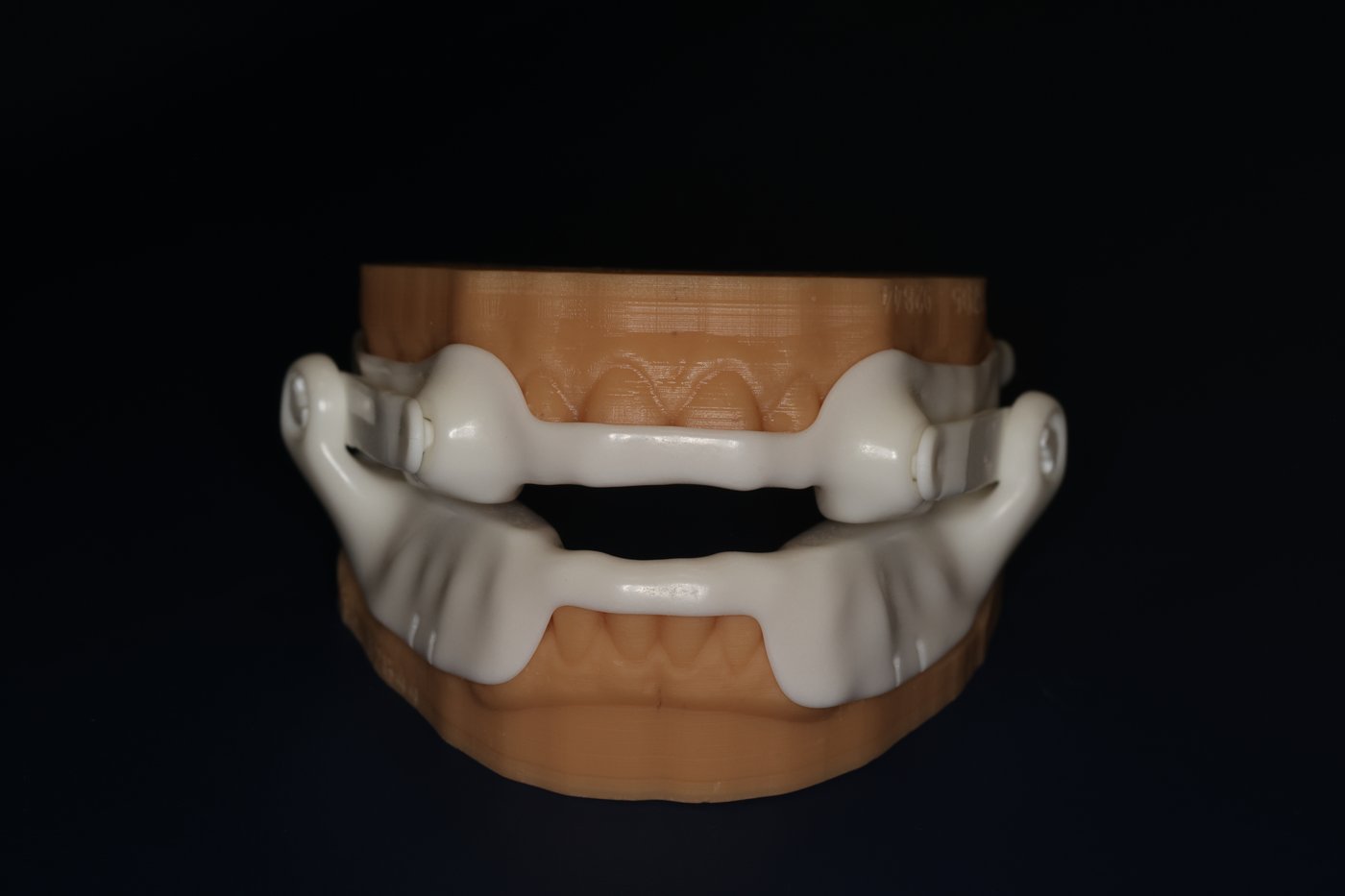 The Panthera oral appliance shown fitted on a dental model, front view